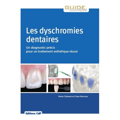 Les dyschromies dentaires