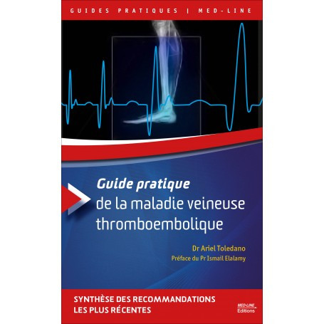 Guide pratique de la maladie veineuse thromboembolique