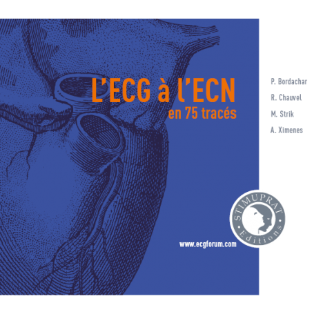 L'ECG à l'ECN