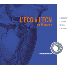 L'ECG à l'ECN