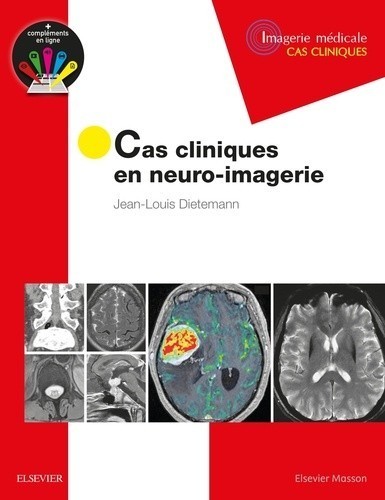 Cas cliniques en neuro-imagerie : pathologies tumorales