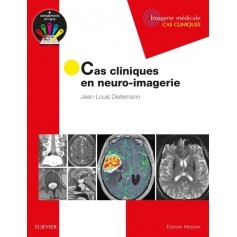 Cas cliniques en neuro-imagerie