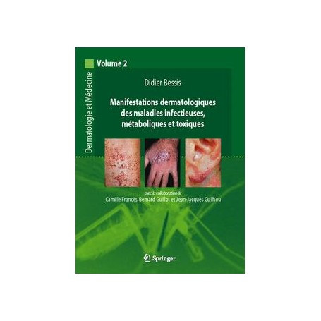 Manifestations dermatologiques des maladies infectieuses, métaboliques et toxiques