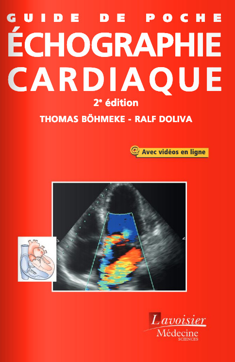 Echographie cardiaque