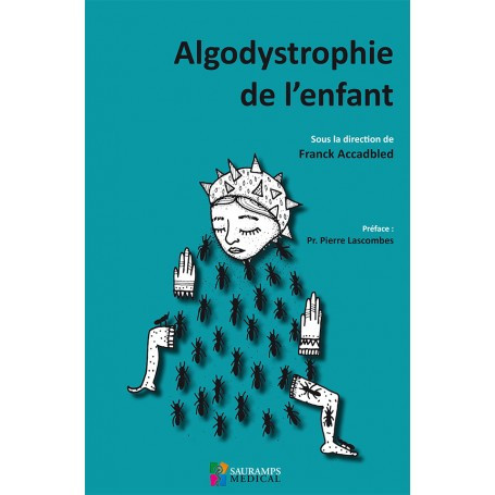 Algodystrophie de l'enfant