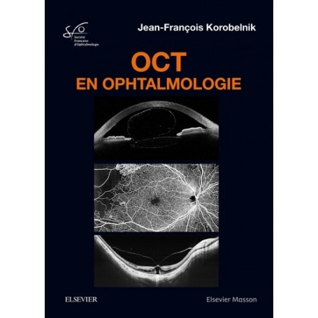 OCT en ophtalmologie - Rapport SFO 2019