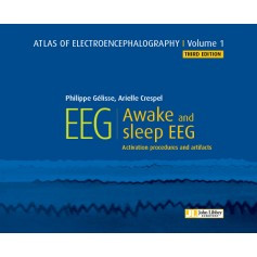 Atlas of electroencephalography, volume 1 : awake and sleep EEG