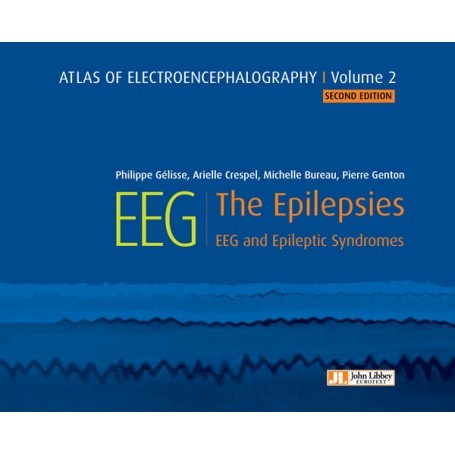 Atlas of electroencephalography, volume 2 : the epilepsies