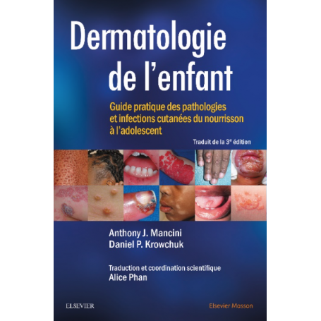 Dermatologie de l'enfant