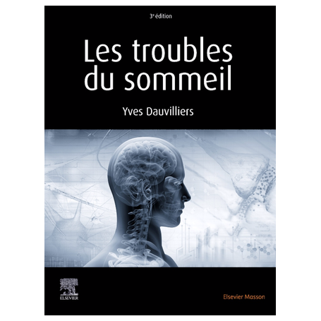 Les troubles du sommeil