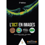 L'OCT en images