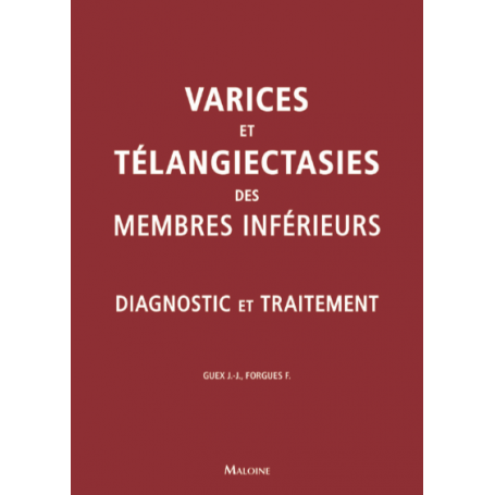 Varices et télangiectasies des membres inférieurs