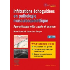 Infiltrations échoguidées en pathologie musculosquelettique