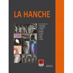 La hanche