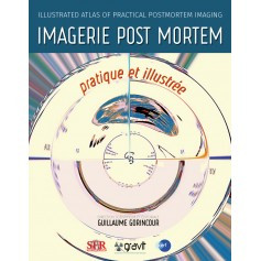 Imagerie post-mortem pratique et illustrée