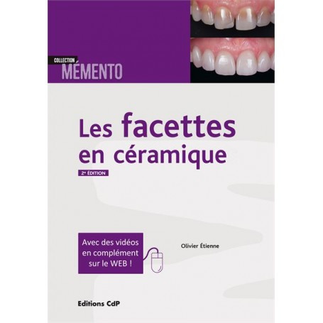 Les facettes en céramique