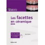 Les facettes en céramique