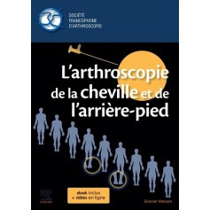 L'arthroscopie de la cheville et de l'arrière-pied