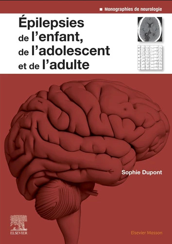 Epilepsies de l'enfant, de l'adolescent et de l'adulte