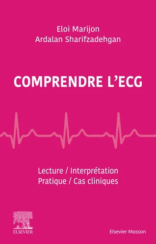 Comprendre l'ECG