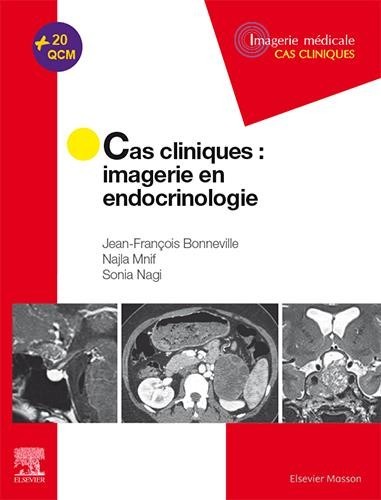 Cas cliniques en imagerie : endocrinologie