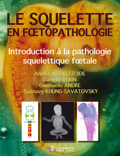 Le squelette en foetopathologie