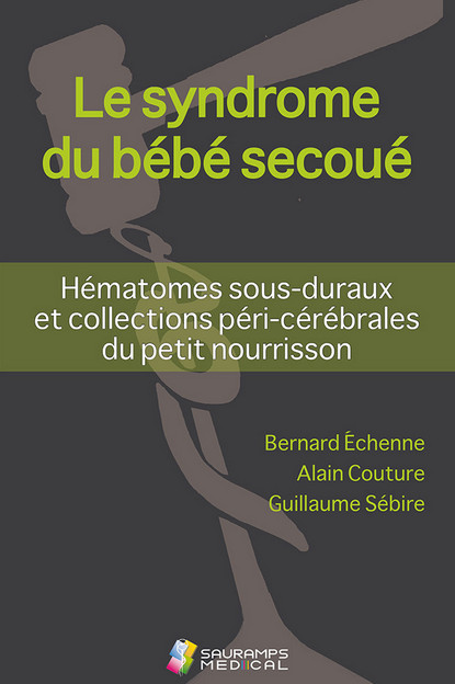 Le syndrome du bébé secoué