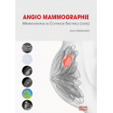Angio-mammographie, mammographie de contraste spectrale