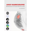 Angio-mammographie, mammographie de contraste spectrale