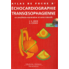 Echocardiograhie transœsophagienne