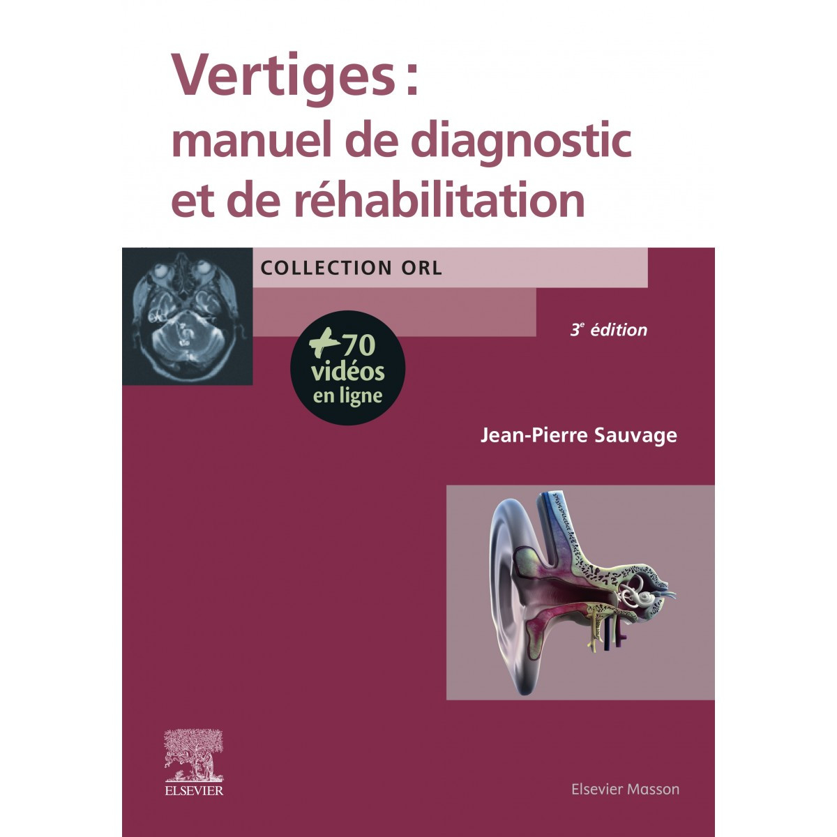 Vertiges : manuel de diagnostic et de réhabilitation