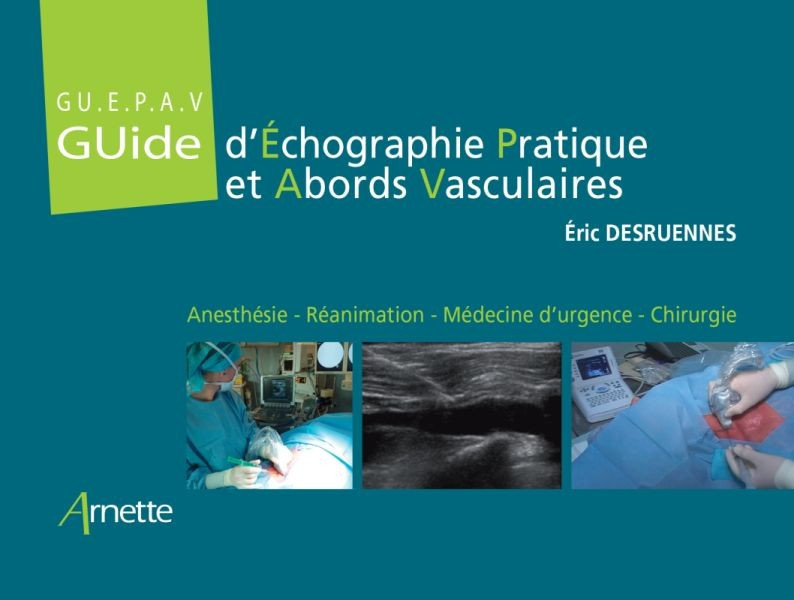 Guide d'échographie pratique des abords vasculaires