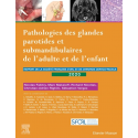 Pathologies des glandes parotides et submandibulaires de l\'adulte et de l\'enfant