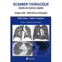 Scanner thoracique