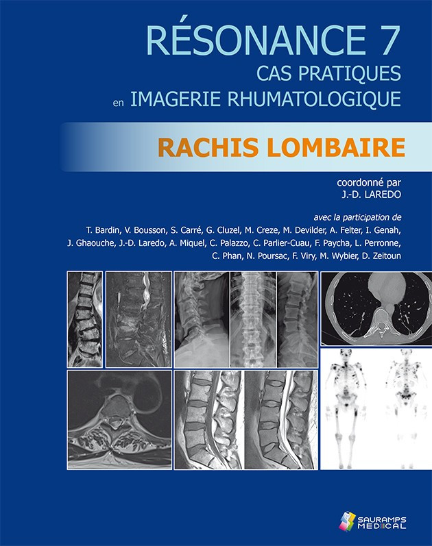 Résonance 7 : rachis lombaire