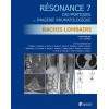 Résonance 7 : rachis lombaire