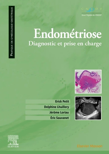 Endométriose