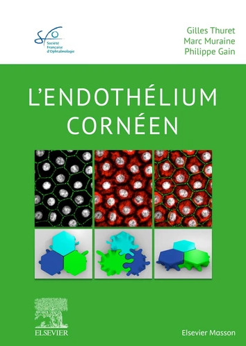 L'endothélium cornéen