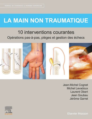 La main non traumatique