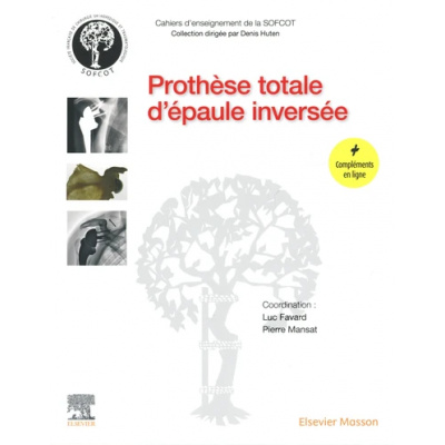 Prothèse totale d'épaule...