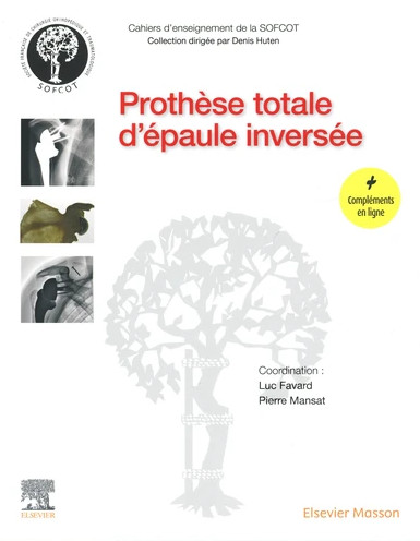 Prothèse totale d'épaule inversée