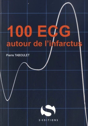 100 ECG infarctus