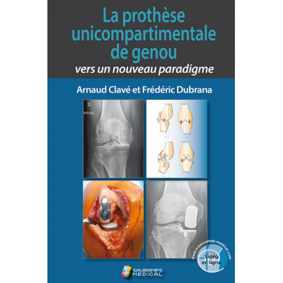 La prothèse...