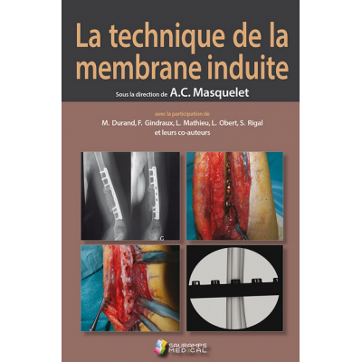 La technique de la membrane...