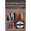 La technique de la membrane induite