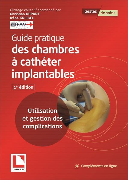 Guide pratique des chambres à cathéter implantables