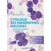 Cytologie des hémopathies malignes