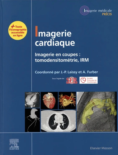 Imagerie cardiaque