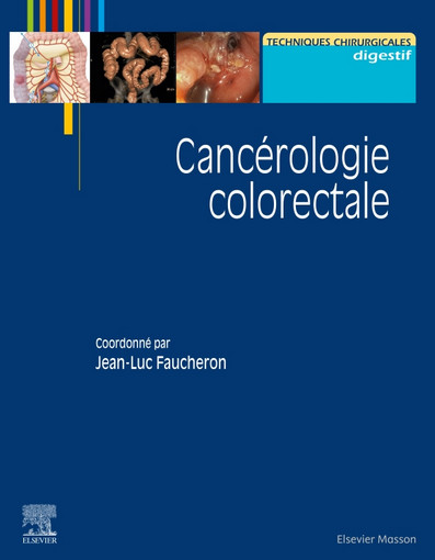 Cancérologie colorectale