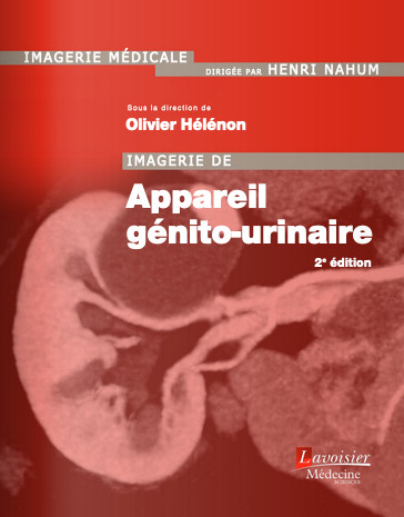 Imagerie de l'appareil génito-urinaire